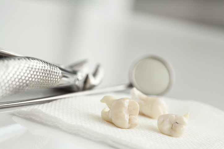 Removed wisdom tooth on white a close up of a pair of scissors and toothpaste.